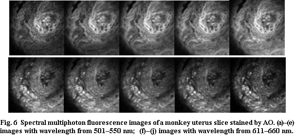 Text Box:      

     
Fig. 6  Spectral multiphoton fluorescence images of a monkey uterus slice stained by AO.  (a)(e) images with wavelength from 501550 nm;  (f)(j) images with wavelength from 611660 nm.

